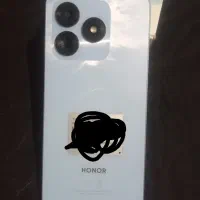 سلام گوشی HONOR X 5c