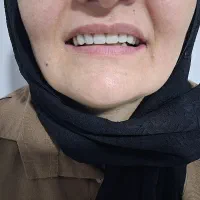 ساخت دندان|خدمات آرایشگری و زیبایی|خرمدره, |دیوار