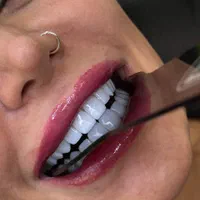 کامپوزیت بدون تراش  باقیمت استثنایی|خدمات آرایشگری و زیبایی|آمل, |دیوار