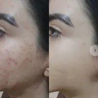 پاکسازی و فیشال تخفیف باور نکردنی