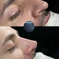 عمل بینی با ما