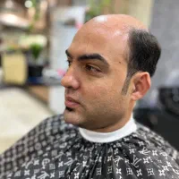 خدمات کامل پروتز مو در اصفهان|خدمات آرایشگری و زیبایی|اصفهان, دستگرده|دیوار