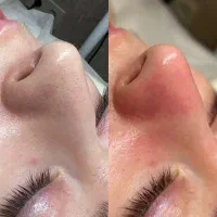 فیشیال تخصصی