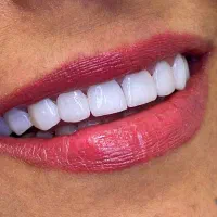 دستیار دندانپزشک