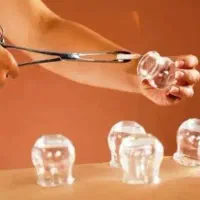 انواع حجامت و بادکش و فصد خون در مطب و در منزل