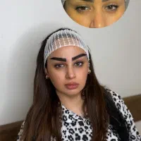 کاشت میکرو ابرو کاشت مو ریش آقایان با متد روز دنیا