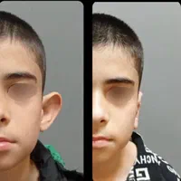 عمل گوش حرفه‌ای  مشاوره رایگان