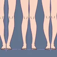 کلینیک تخصصی اصلاح غیرجراحی انحرافات زانو