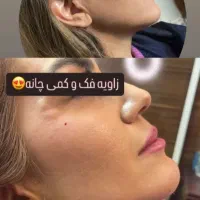 تخفیف 10 تا 20 درصدکلیه خدمات زیبایی در شمس ابادی|خدمات آرایشگری و زیبایی|اصفهان, خلجا|دیوار