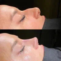 پیکرتراشی، لیفت سینه، عمل بینی ،جراح پلاستیک خانم