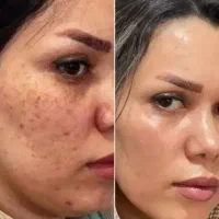 معطمن باش پشیمون نمیشی