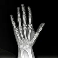 رادیولوژی در منزل آلارا|خدمات آرایشگری و زیبایی|مشهد, احمدآباد|دیوار