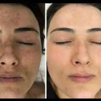 درمان از دل طبیعت