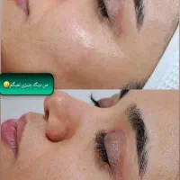 فیشیال تخصصی با بهترین برندو متریال کره ای