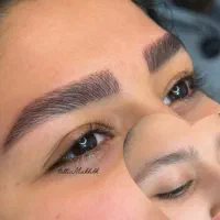 میکروبلیدینگ کرکی و مویی