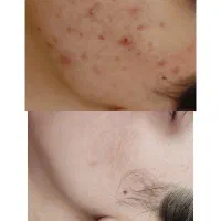 فیشیال و پاکسازی تخصصی، مدرک فنی‌وحرفه‌ای ،لاهیجان