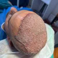 تخفیف ویژه کاشتمو