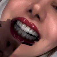 تخفیف ویژه کامپوزیت یلدایی