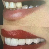 دندانپزشکی|خدمات آرایشگری و زیبایی|شهر ری, دیلمان|دیوار