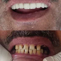 دندان پزشکی و دندانسازی تعرفه دولتی