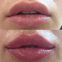 ژل صورت وبادی|خدمات آرایشگری و زیبایی|تهران, سلسبیل شمالی|دیوار