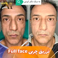 چربی بیکینی لابیا پلاستی تنگی انواع جراحی لیفت|خدمات آرایشگری و زیبایی|شیراز, شهرک گلستان|دیوار