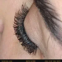کاشت مژه هیدن