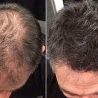 از یدونه تار موهم نباید بگذری