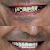 دندانپزشکی/کامپوزیت دیجیتال/ ایمپلنت/عصب کشی|خدمات آرایشگری و زیبایی|مشهد, ده دی|دیوار