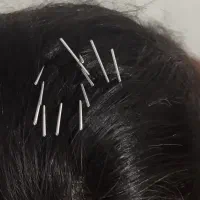 سوزن ، طب سوزنی ،