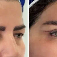 جراحی شقیقه بینی بلفارولیپو ابدو دندانپزشکی بوتاکس