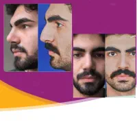 عمل بینی با جراح متخصص قیمت منصفانه