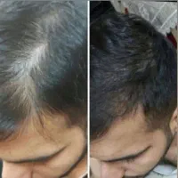 مو بلند شده
