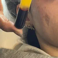 جوانسازی با پی آرپی و لایه برداری پوست  فقط۳۹۹|خدمات آرایشگری و زیبایی|اصفهان, طامه|دیوار