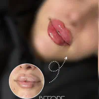 مطب زیبایی دکتر کاوندی