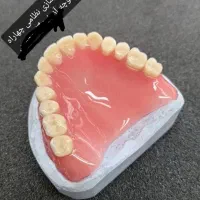 ساخت دندان مصنوعی سرامیکی دریک روز|آرایشی، بهداشتی، درمانی|زابل, |دیوار