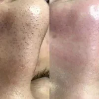 رنگ مو و پاکسازی پوست رایگان