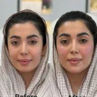 کلینیک زیبایی خدمات فیلر بوتاکس مزوژل PRP|خدمات آرایشگری و زیبایی|اهواز, کیان اباد|دیوار