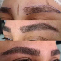 میکروبلیدینگ به روش هایپر نچرال