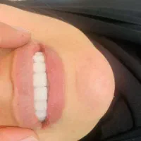 دندانپزشکی|خدمات آرایشگری و زیبایی|قشم, |دیوار