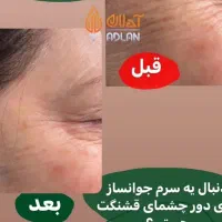 پکیج درمان لک ویژه|آرایشی، بهداشتی، درمانی|تهران, فردوسی|دیوار