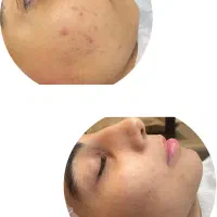 فیشیال تخصصی و روشن کنندگی پوست بانوان‌