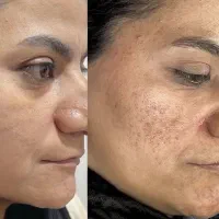 نئو بیوممتیک ۲۰ برابر قوی تر از بیوممتیک
