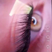 مدل رایگان کاشت هیدن