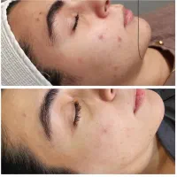 جشنواره درمان.تراپی.فیشیال.بیوتی تراپیست.آموزش