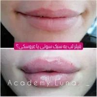 بوتاکس رایگان|خدمات آرایشگری و زیبایی|قم, زنبیل آباد|دیوار