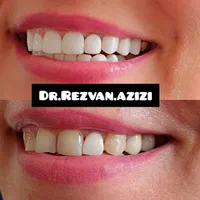 طرح لبخند، کامپویت تخصصی،اقساط،دندانپزشکی زیرتعرفه|خدمات آرایشگری و زیبایی|شیراز, قصرالدشت|دیوار