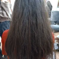 کرابوتاکس فقط یک میلیون با ماندگاری یک سال