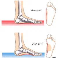 کلینیک تخصصی بهبود کف پای صاف|خدمات آرایشگری و زیبایی|رزن, |دیوار