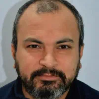 کاشت مو و ابرو با تخفیف یلدایی